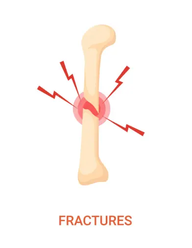 Fracture diagnosis and orthopedic imaging test services