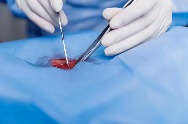 Laparoscopic hernia surgery, treatment, and post-operative care